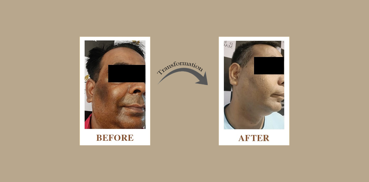 Body Shaping new